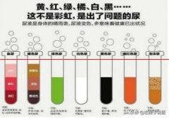 【健康】不同颜色尿液是否预示不同疾病？检验科医生告诉你